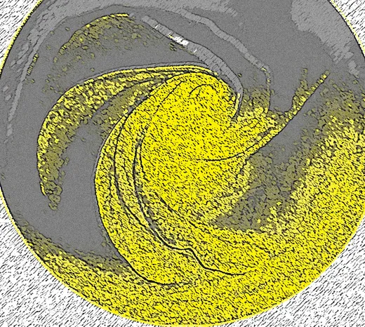 Cholesterin - gut und schlecht